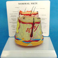 Pathological Human Skin Medical Anatomy Model for Demonstration